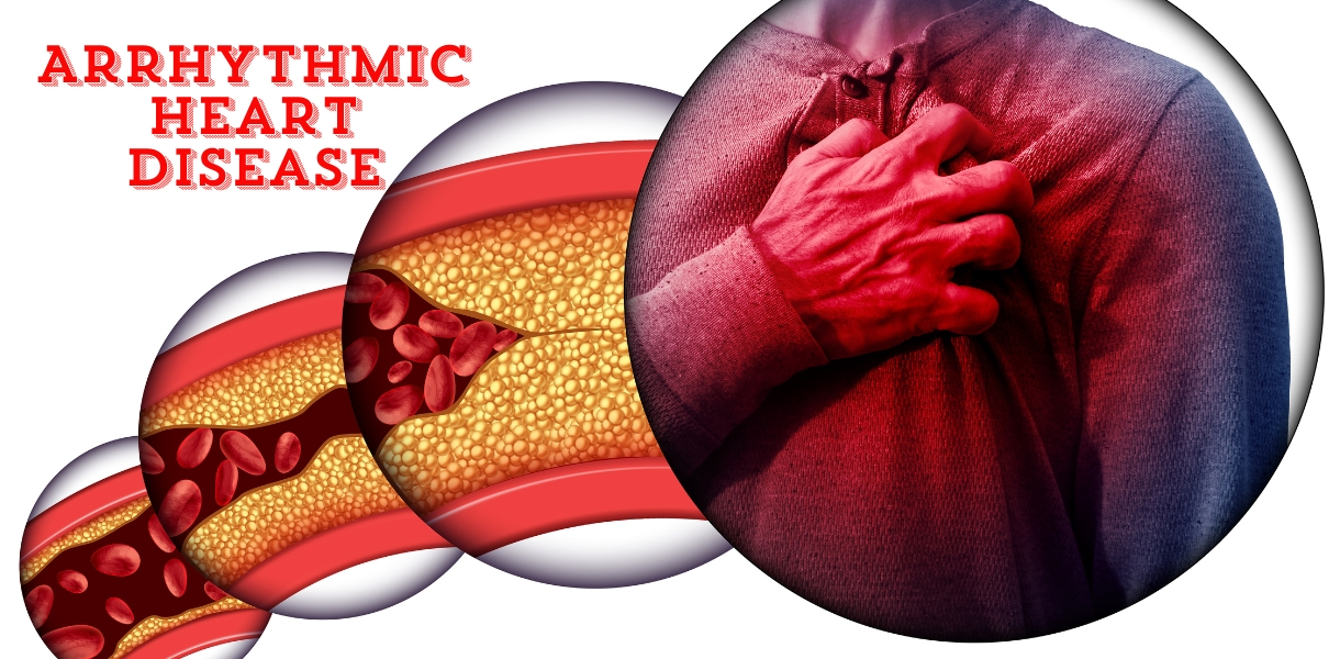 Arrhythmic Heart Disease in pune