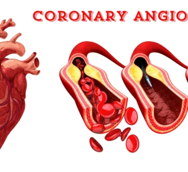 Coronary Angioplasty in pune